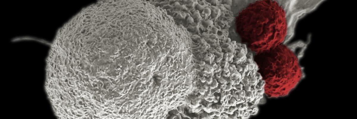 Chughtai Lab banner