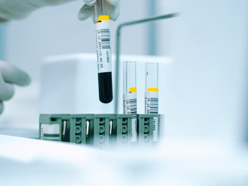 Chughtai Lab Blood Glucose Test